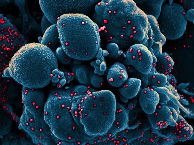 Ученые рассказали, какие условия идеальны для коронавируса: живет 14 дней