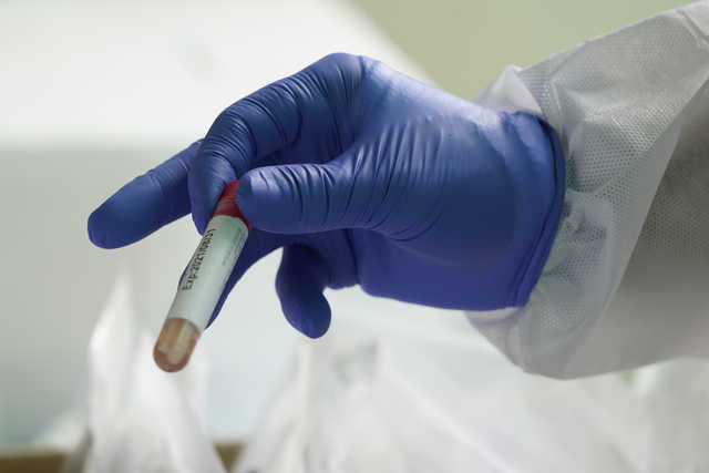 У Білорусі – перша смерть від коронавірусу