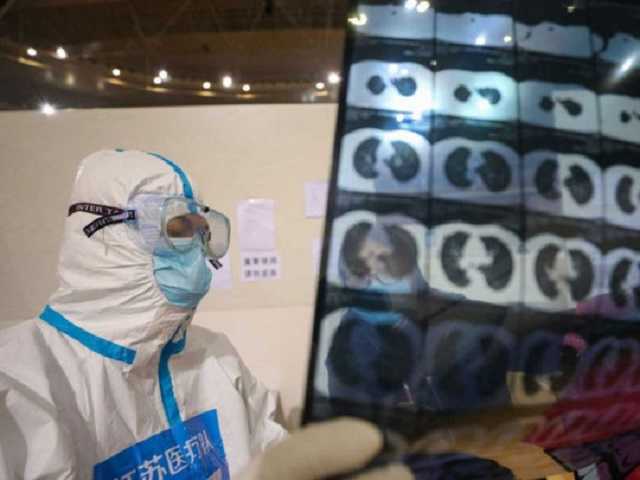 "Цитокиновый шторм": врачи близки к разгадке причины массовой гибели людей от COVID-19