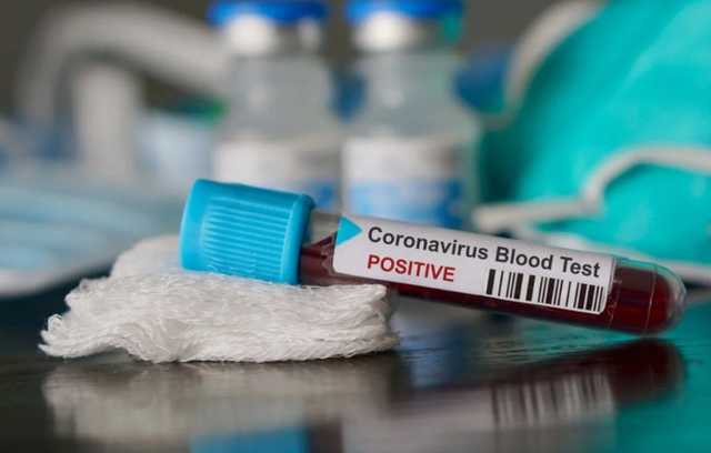 В Хмельницкой области зафиксирована первая смерть от коронавируса