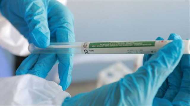 Плюс 325 за сутки: в Украине COVID-19 заразились уже 3102 человек