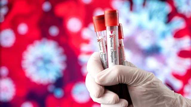 Украина занимает первое место по заболеваемости медиков на COVID-19, – эпидемиолог