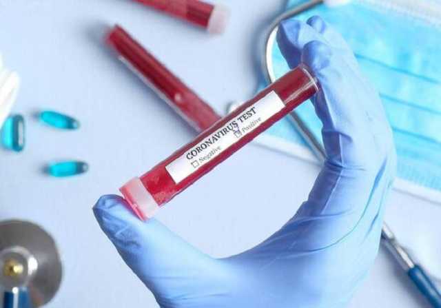 Россия и Украина лидируют по минимуму смертности от коронавируса