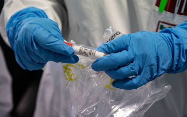 На Буковині зафіксували вже понад 1700 випадків COVID-19