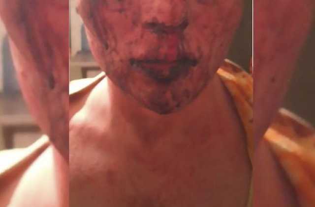 В Житомире спортсмен с группой подростков изнасиловал и избил 19-летнего парня