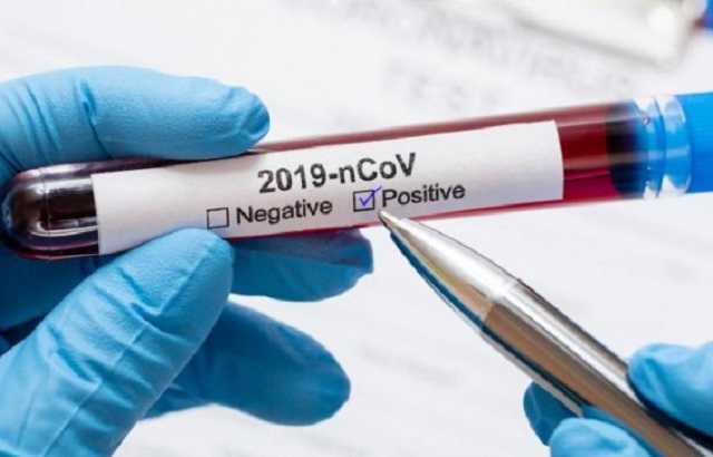 Количество больных COVID-19 в Украине перевалило за 17 тысяч человек