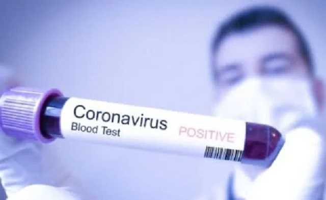 В Крыму зафиксировано 15 новых случаев инфицирования коронавирусом