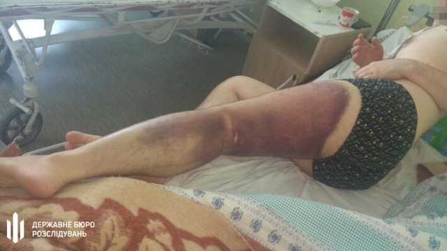 Тело стало синее: На Николаевщине полицейские избили мужчину из-за криптовалюты