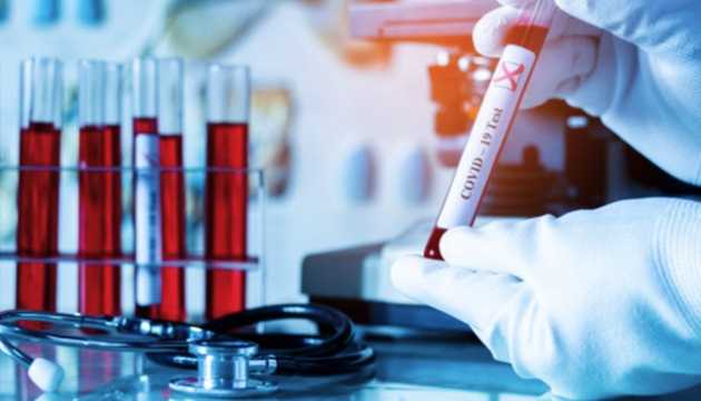 В Австрии начали продавать ПЦР-тесты на Covid-19, которые можно сделать дома самому