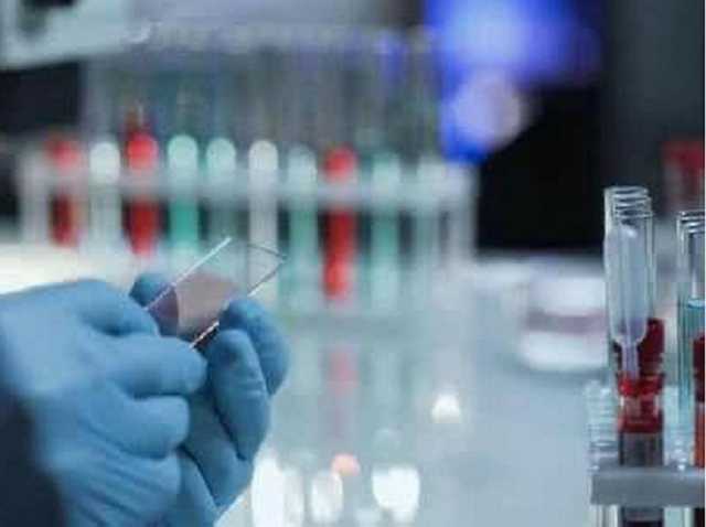 Врач объяснил, как отличить вирусную пневмонию от бактериальной