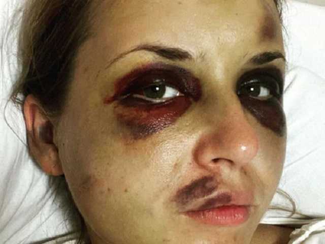 Состояние избитой в поезде Мариуполь — Киев женщины ухудшилось