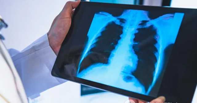 В теле человека нашли места, где прячется коронавирус после выздоровления