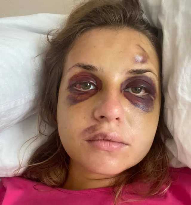 Луговая пожаловалась на усилившуюся боль после нападения в поезде