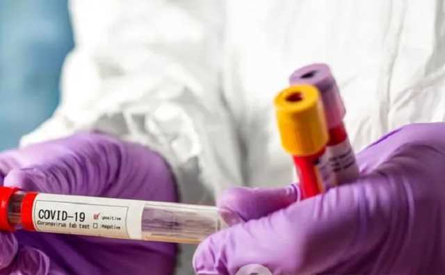 Инфекционист назвал два фактора роста больных коронавирусом в Украине