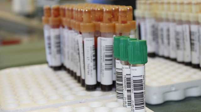 Заболеваемость коронавирусом в Румынии приближается к рекордным показателям