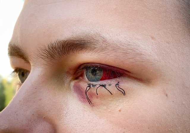 За два миллиметра от смерти: в Беларуси спасают 19-летнего парня, зверски избитого силовиками