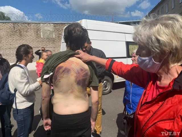 Лукашенко заявил, что большинство фото искалеченных силовиками людей постановочные