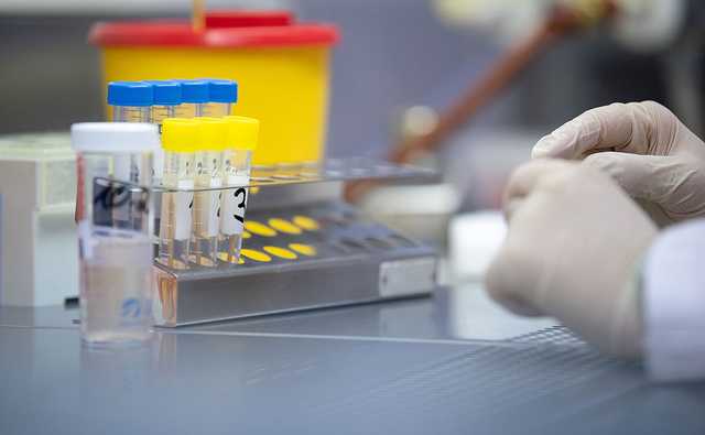 МОЗ за добу скоротив кількість ПЛР-тестувань майже на 40%