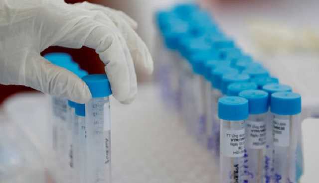 В Украине 1 670 новых случаев COVID-19 за сутки