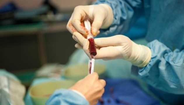В Україні вперше провели операцію з трансплантації кісткового мозку за державні гроші