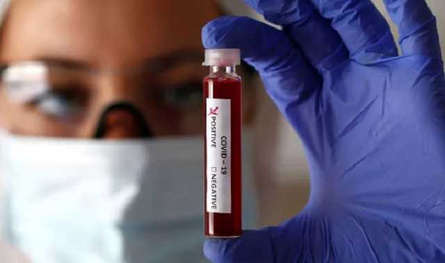 В Украине за сутки 2 141 новый случай коронавируса