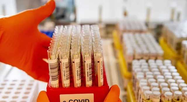 Тесты на COVID-19 станут массовыми в Украине, медиков будет не хватать, – экс-главный санврач