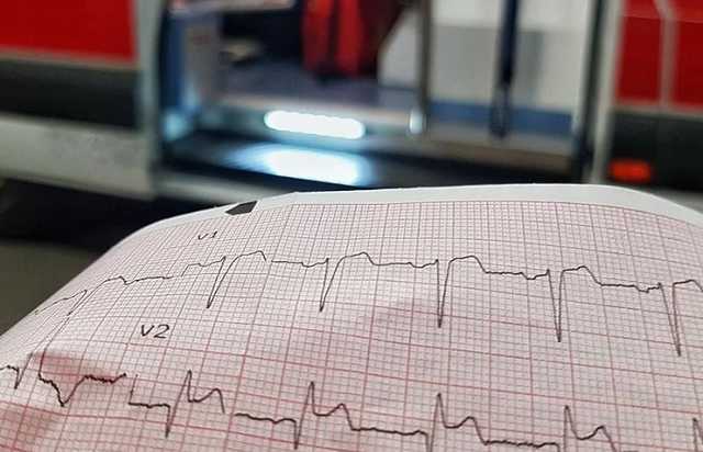 Минздрав увеличил расходы на лечение инфаркта миокарда до 37 тысяч