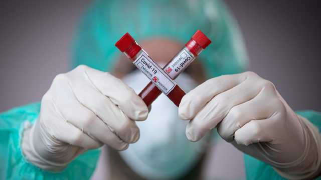 В Одесі лабораторний центр МОЗ перевантажений біозразками для тестування на COVID-19