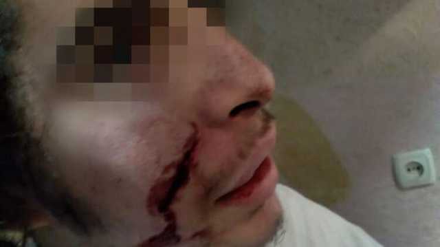 В Умани неизвестные с ножом напали на подростков-хасидов