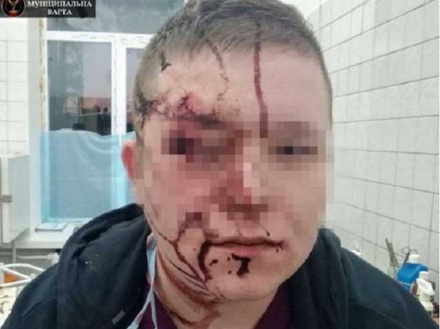 Врачу разбил голову взбунтовавшийся пациент в киевской больнице