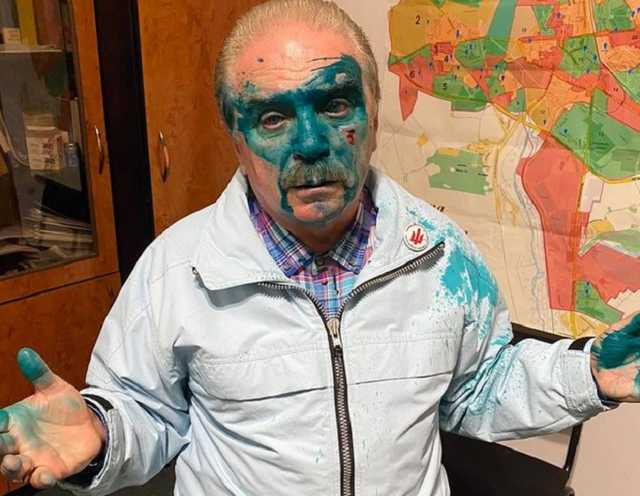 В Тернополе облили зеленкой кандидата на должность мэра от партии Ляшко Барну