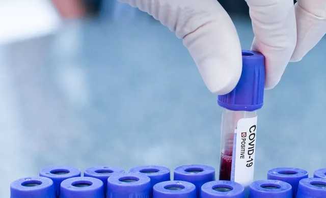 Только в двух областях Украины зафиксировали менее 100 новых больных COVID-19