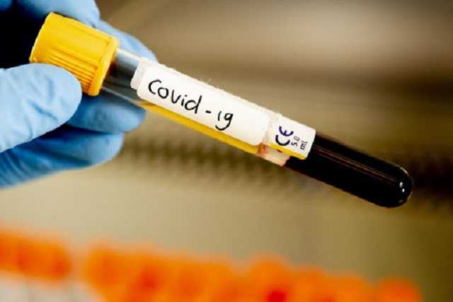 В Украине за сутки выявлены 6 677 новых случаев COVID-19