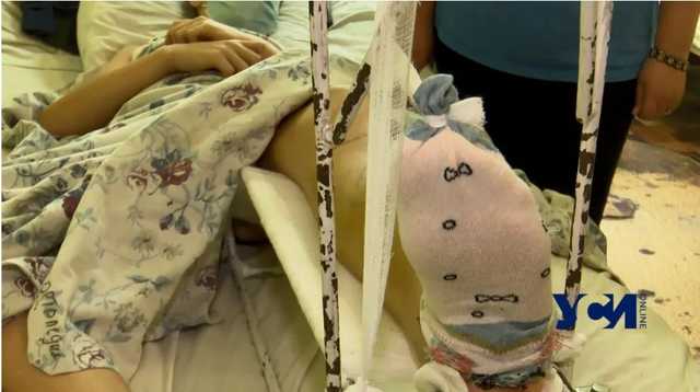 На Одесщине учительница сказала вынести на улицу школьника со сломанной ногой: детали инцидента