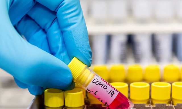 Инфекционист Галимский: с вакцинацией от COVID-19 в Украине будут большие проблемы