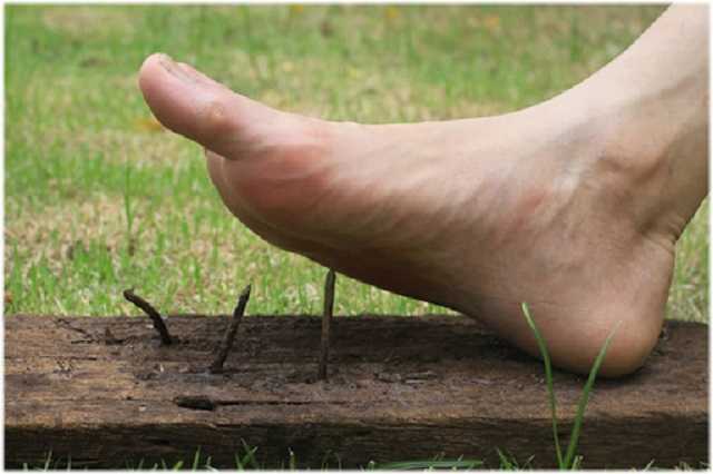 В МОЗ сообщили, сколько непривитых украинцев заболели столбняком в этом году