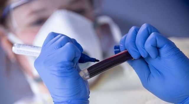 Мутировавший коронавирус из Великобритании зафиксирован в Украине, — врач-инфекционист