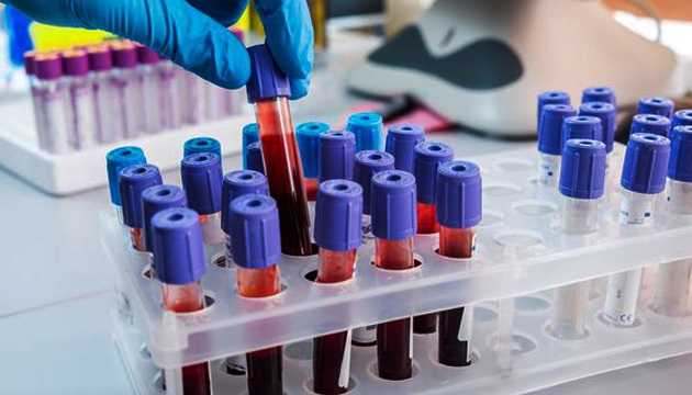 У Канаді виявили “південноафриканський” штам коронавірусу