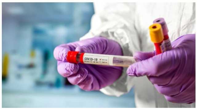  .        Covid-19  - 