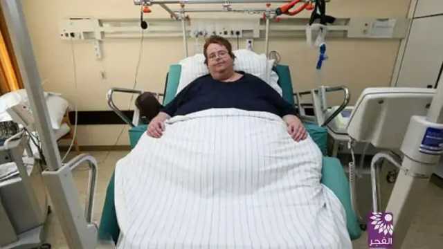 В США мужчине с ожирением случайно сделали кесарево сечение