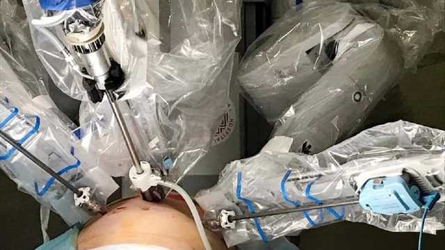 Львівські хірурги з допомогою робота прооперували 69-річного чоловіка