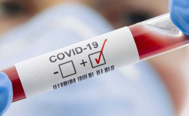 COVID-статистика ухудшается: в Украине 11 476 новых заражений