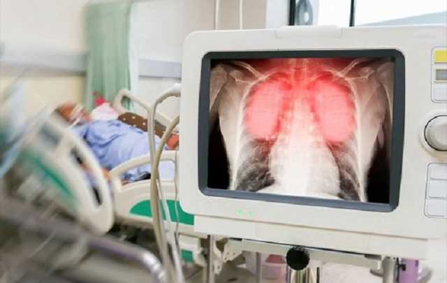 Коронавірус б’є по слабких місцях організму людини, – доктор медичних наук