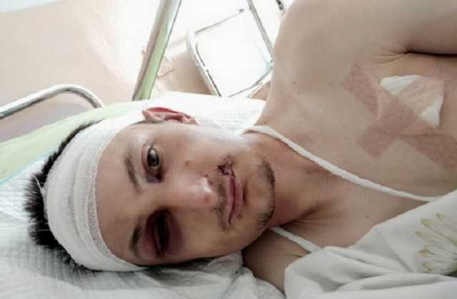 Под Черкассами злоумышленники похитили и зверски пытали бизнесмена