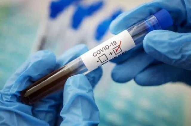 Не та болезнь, что год назад: медик о новых симптомах COVID-19