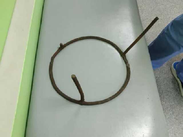 На Полтавщине спасли 6-летнего мальчика, который напоролся на металлический штырь