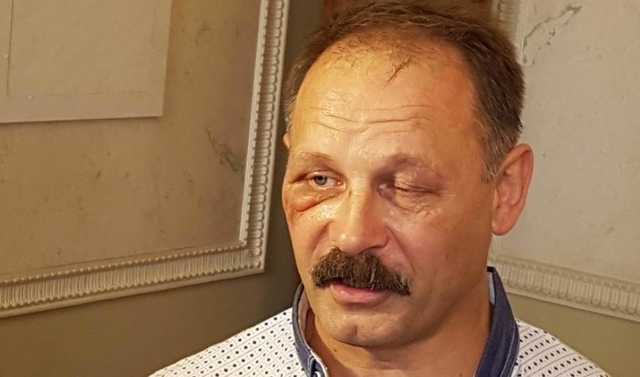 «Неадекват» якого потрібно відправити на «лікування»: реакція мережі на витівку екс-нардепа Барни