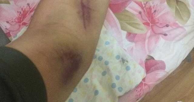 Молодой военнослужащий рассказал об издевательствах в воинской части в Одессе