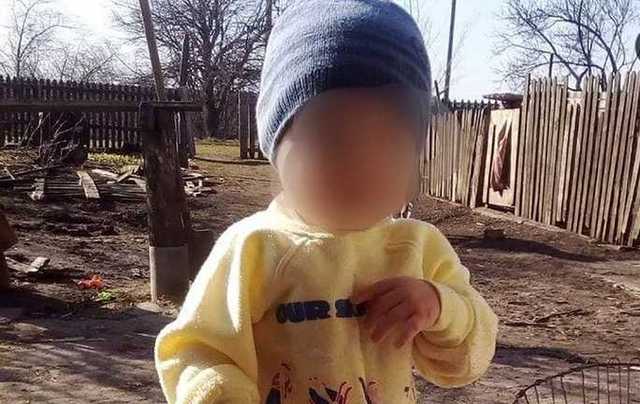 Отказал мозг: что известно о состоянии 2-летнего мальчика, которого порезал отчим