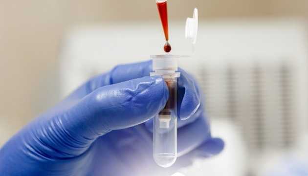 «Новые подозрения на «Дельту»: Кузин озвучил ситуацию с опасным штаммом в Украине